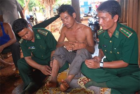 Chuyện người làng cùi