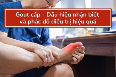 Gout cấp - Dấu hiệu nhận biết và phác đồ điều trị hiệu quả
