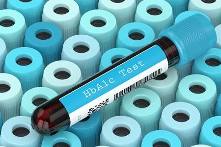 Chỉ số HbA1c bao nhiêu là nguy hiểm? Bao nhiêu là bị tiểu đường?