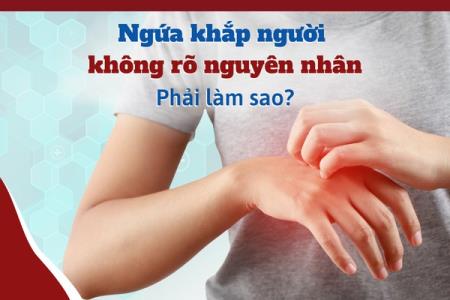 Bị ngứa khắp người không rõ nguyên nhân phải làm sao?
