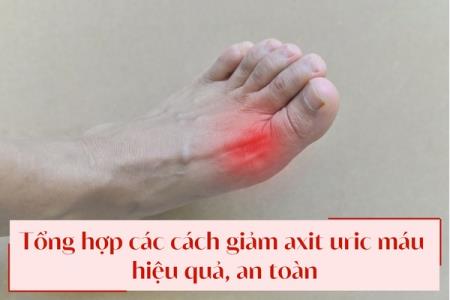 Tổng hợp các cách giảm axit uric máu hiệu quả, an toàn