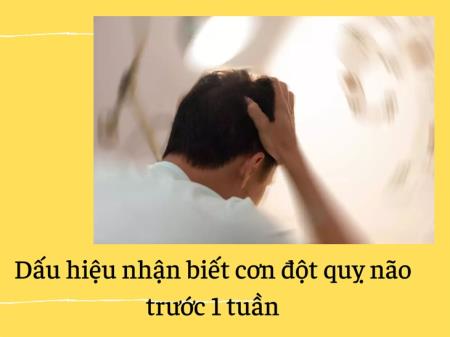 Nhận biết dấu hiệu đột quỵ trước 1 tuần để có cách phòng ngừa hiệu quả