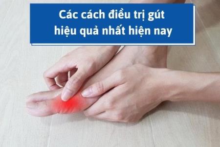 Cập nhật các cách điều trị gút hiệu quả nhất hiện nay