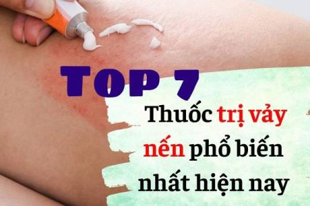 Thuốc trị vảy nến và những điều cần biết để dùng hiệu quả