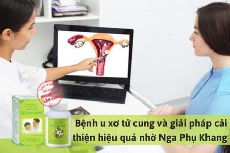 Bệnh u xơ tử cung và giải pháp cải thiện an toàn, hiệu quả nhờ Nga Phụ Khang