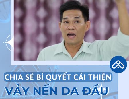 Hết ngứa ngáy, bong tróc vì vảy nến da đầu chỉ sau 2 tháng nhờ cách đơn giản này