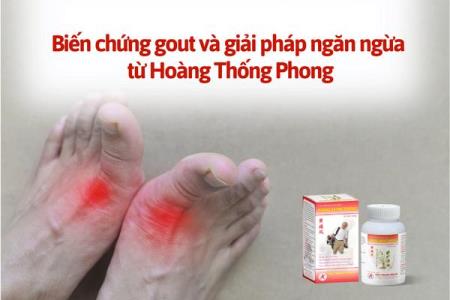 Cảnh báo biến chứng gout nguy hiểm và cách phòng ngừa hiệu quả